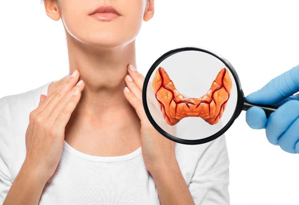 Hypothyroidism: What It Is and How It Affects Your Life